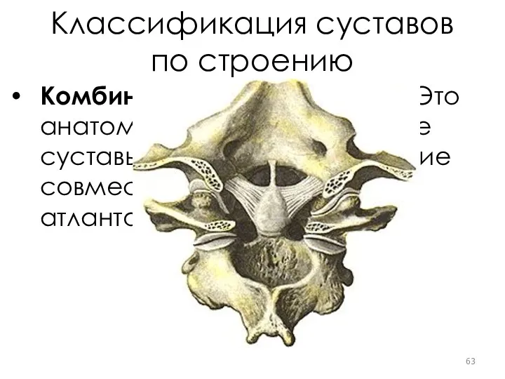 Классификация суставов по строению Комбинированные суставы. Это анатомически изолированные суставы, но функционирующие совместно.