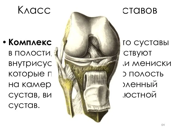 Классификация суставов по строению Комплексные суставы. Это суставы в полости, которых присутствуют внутрисуставные
