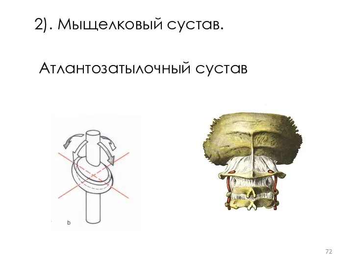 2). Мыщелковый сустав. Атлантозатылочный сустав