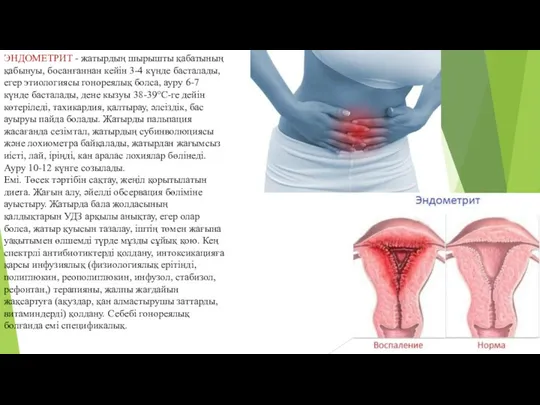 ЭНДОМЕТРИТ - жатырдың шырышты қабатының қабынуы, босанғаннан кейін 3-4 күнде