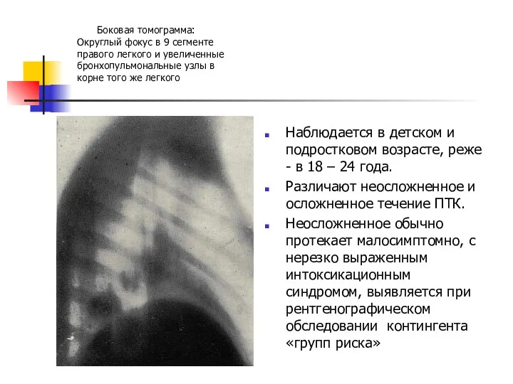 Боковая томограмма: Округлый фокус в 9 сегменте правого легкого и увеличенные бронхопульмональные узлы
