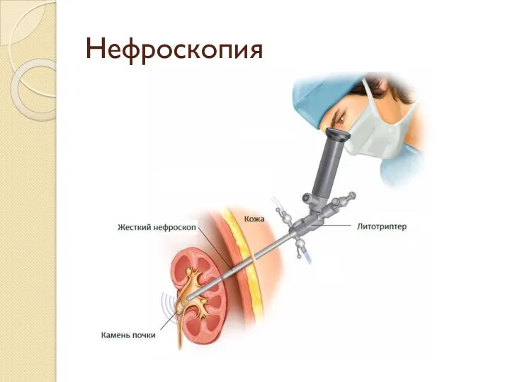 Нефроскопия