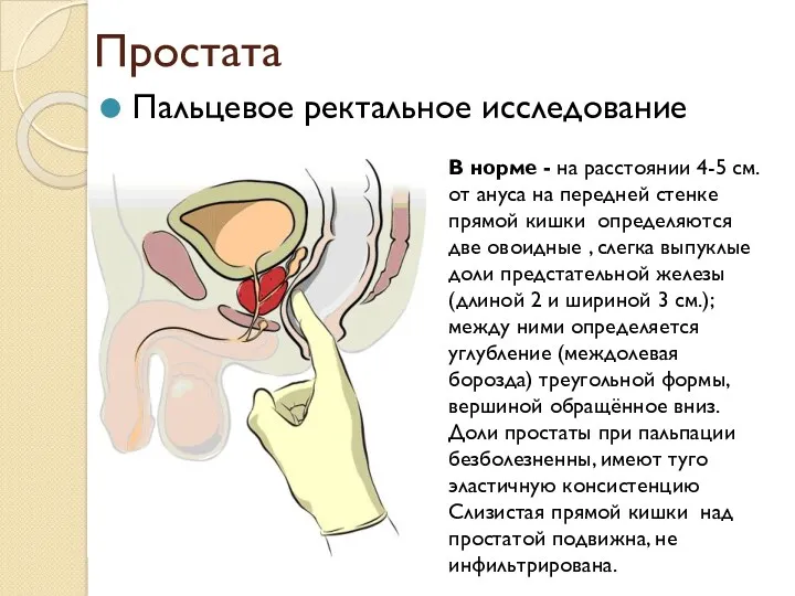 Простата Пальцевое ректальное исследование В норме - на расстоянии 4-5