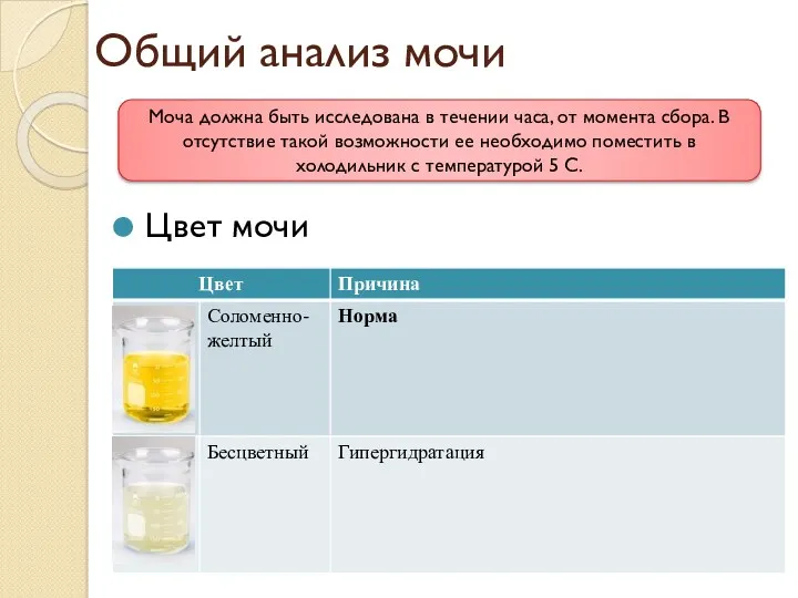 Общий анализ мочи Цвет мочи Моча должна быть исследована в