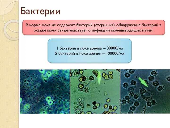 Бактерии В норме моча не содержит бактерий (стерильна), обнаружение бактерий