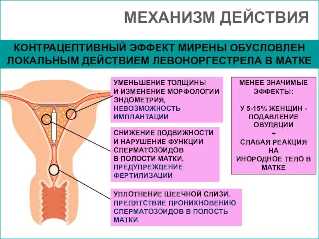 МЕХАНИЗМ ДЕЙСТВИЯ УМЕНЬШЕНИЕ ТОЛЩИНЫ И ИЗМЕНЕНИЕ МОРФОЛОГИИ ЭНДОМЕТРИЯ, НЕВОЗМОЖНОСТЬ ИМПЛАНТАЦИИ