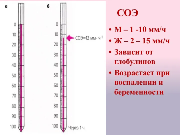 СОЭ М – 1 -10 мм/ч Ж – 2 –