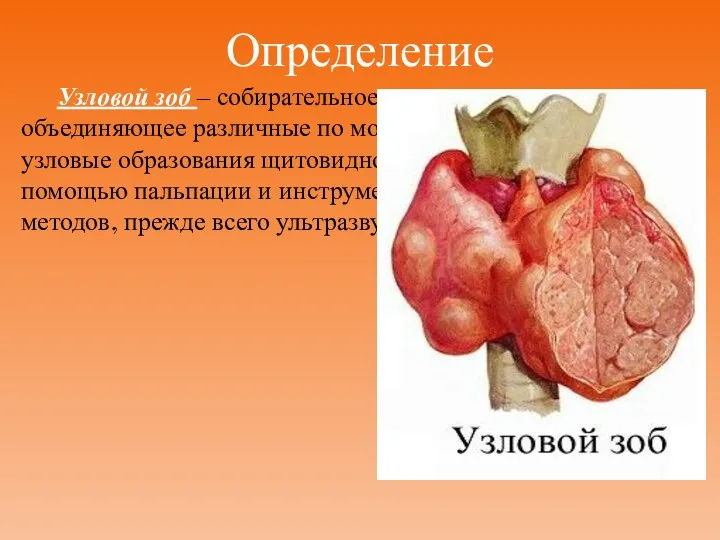 Определение Узловой зоб – собирательное клиническое понятие, объединяющее различные по