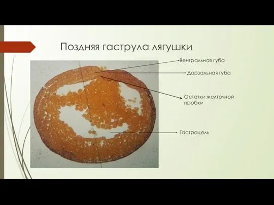 Поздняя гаструла лягушки Гастроцель Дорзальная губа Вентральная губа Остатки желточной пробки