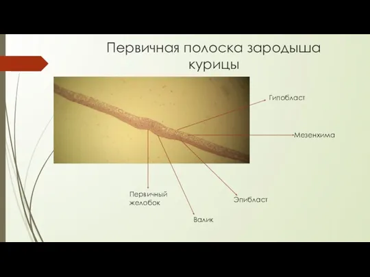 Первичная полоска зародыша курицы Первичный желобок Эпибласт Гипобласт Валик Мезенхима