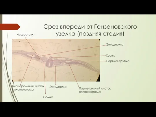 Срез впереди от Гензеновского узелка (поздняя стадия) Хорда Нервная трубка Эктодерма Париетальный листок
