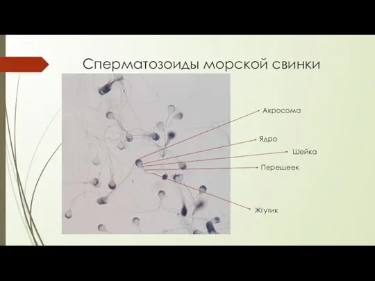 Сперматозоиды морской свинки Акросома Ядро Перешеек Жгутик Шейка