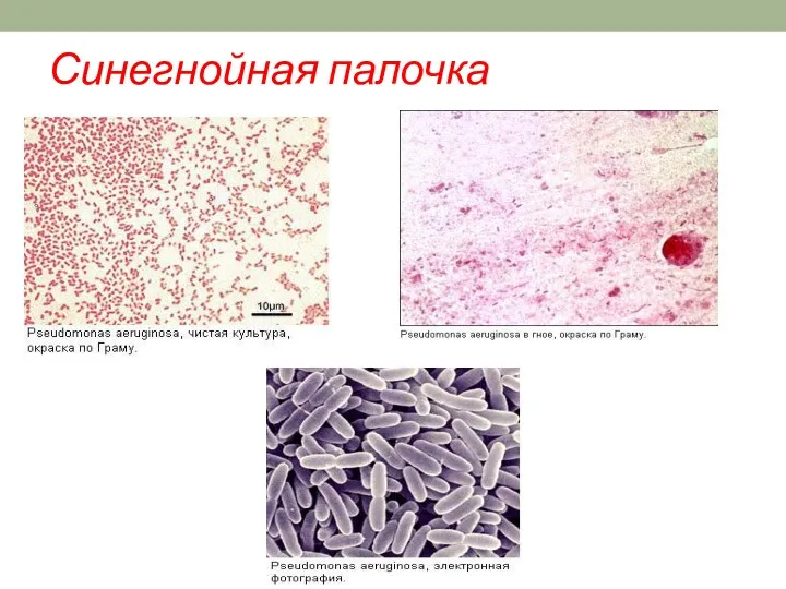 Синегнойная палочка