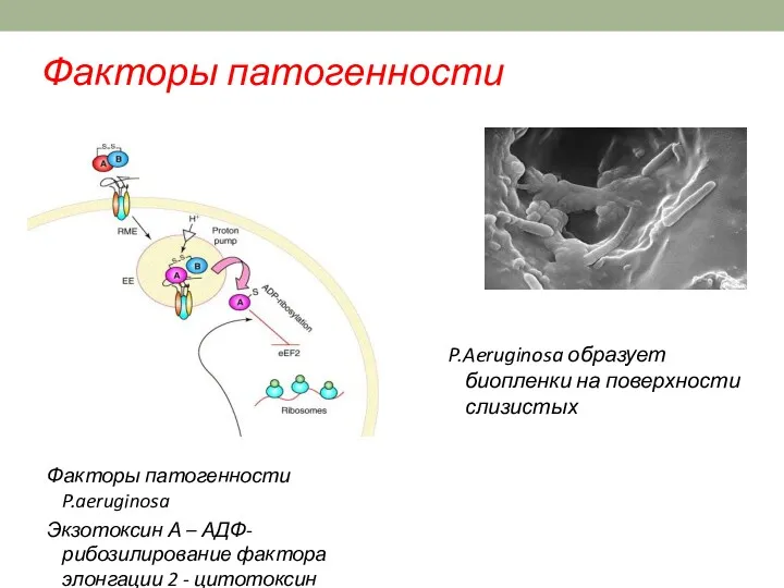 Факторы патогенности Факторы патогенности P.aeruginosa Экзотоксин А – АДФ-рибозилирование фактора