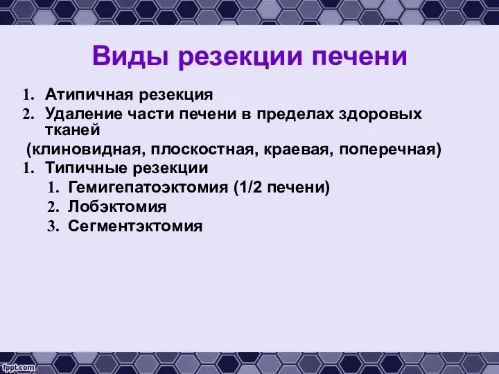 Виды резекции печени Атипичная резекция Удаление части печени в пределах