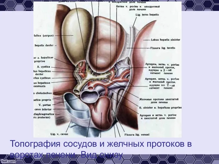 Топография сосудов и желчных протоков в воротах печени. Вид снизу