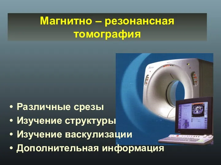 Магнитно – резонансная томография Различные срезы Изучение структуры Изучение васкулизации Дополнительная информация