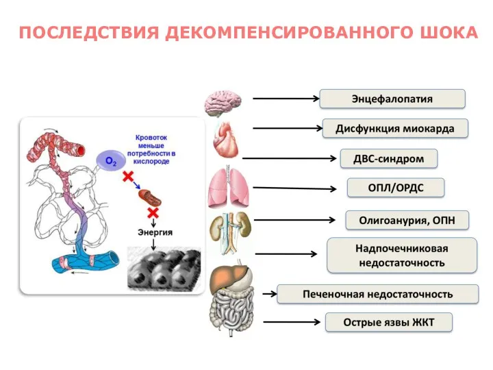 ПОСЛЕДСТВИЯ ДЕКОМПЕНСИРОВАННОГО ШОКА