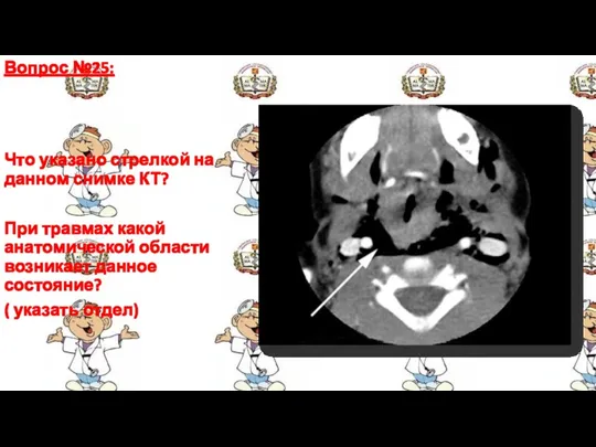 Вопрос №25: Что указано стрелкой на данном снимке КТ? При