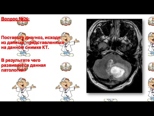 Вопрос №26: Поставьте диагноз, исходя из данных, представленных на данном