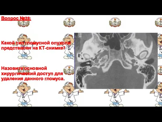 Вопрос №28: Какой тип гломусной опухоли представлен на КТ-снимке? Назовите