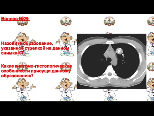 Вопрос №29: Назовите образование, указанное стрелкой на данном снимке КТ. Какие анатомо-гистологические особенности присущи данному образованию?