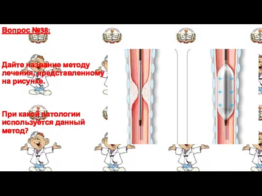 Вопрос №38: Дайте название методу лечения, представленному на рисунке. При какой патологии используется данный метод?