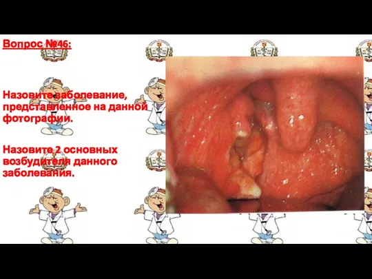 Вопрос №46: Назовите заболевание, представленное на данной фотографии. Назовите 2 основных возбудителя данного заболевания.