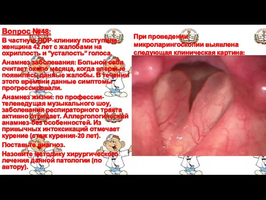 Вопрос №48: В частную ЛОР-клинику поступила женщина 42 лет с