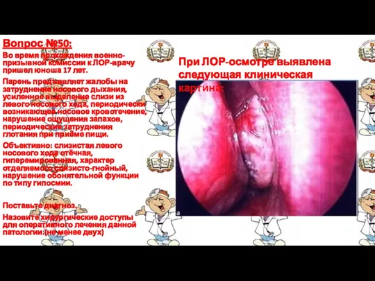 Вопрос №50: Во время прохождения военно-призывной комиссии к ЛОР-врачу пришел
