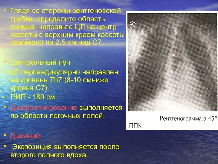 Глядя со стороны рентгеновской трубки, определите область снимка, направьте ЦЛ