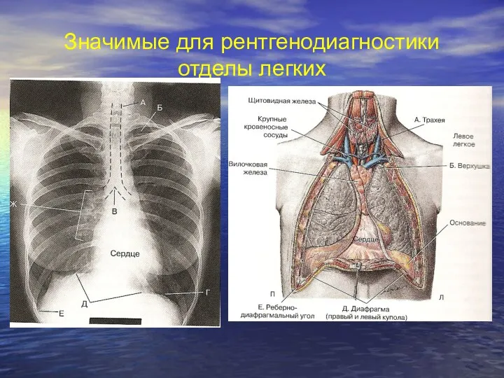 Значимые для рентгенодиагностики отделы легких