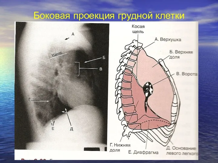 Боковая проекция грудной клетки