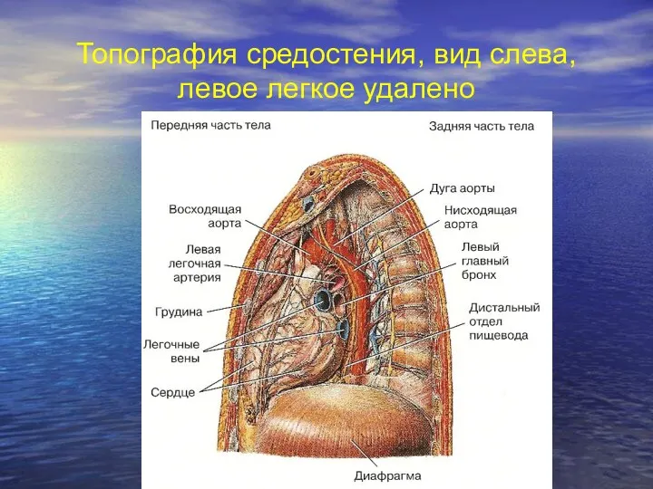 Топография средостения, вид слева, левое легкое удалено