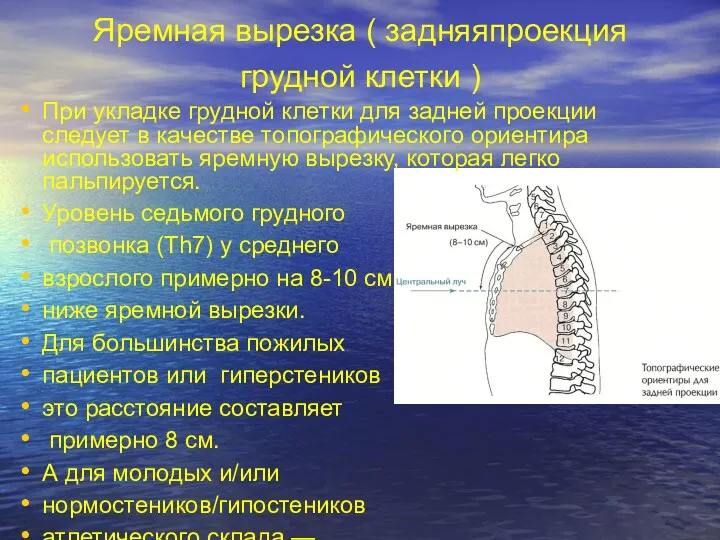 Яремная вырезка ( задняяпроекция грудной клетки ) При укладке грудной