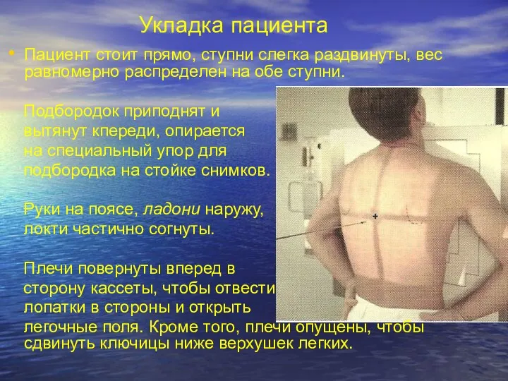 Укладка пациента Пациент стоит прямо, ступни слегка раздвинуты, вес равномерно