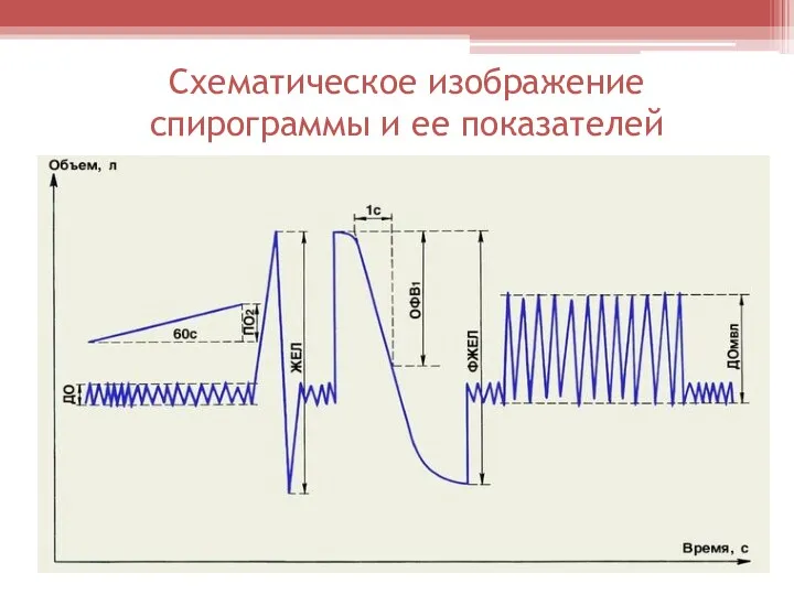 Схематическое изображение спирограммы и ее показателей