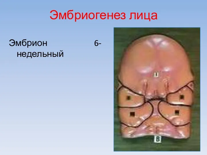 Эмбриогенез лица Эмбрион 6-недельный