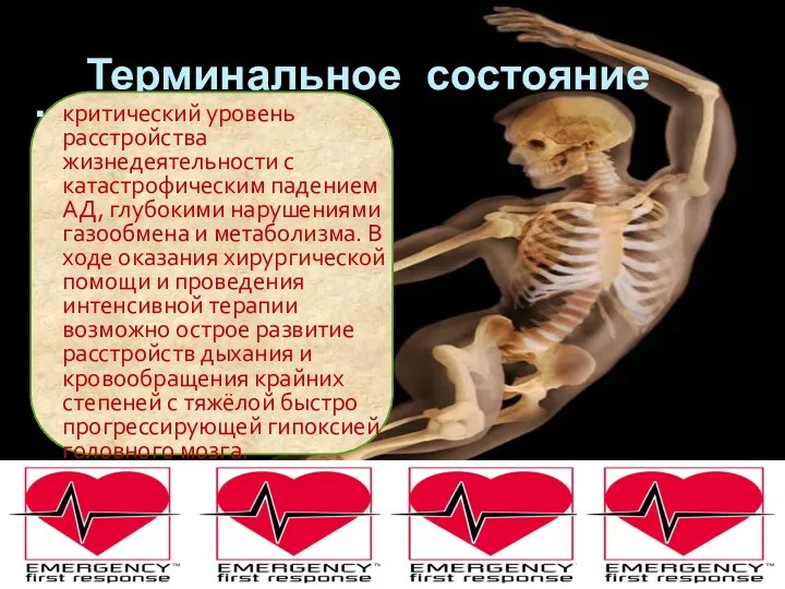 Терминальное состояние критический уровень расстройства жизнедеятельности с катастрофическим падением АД,