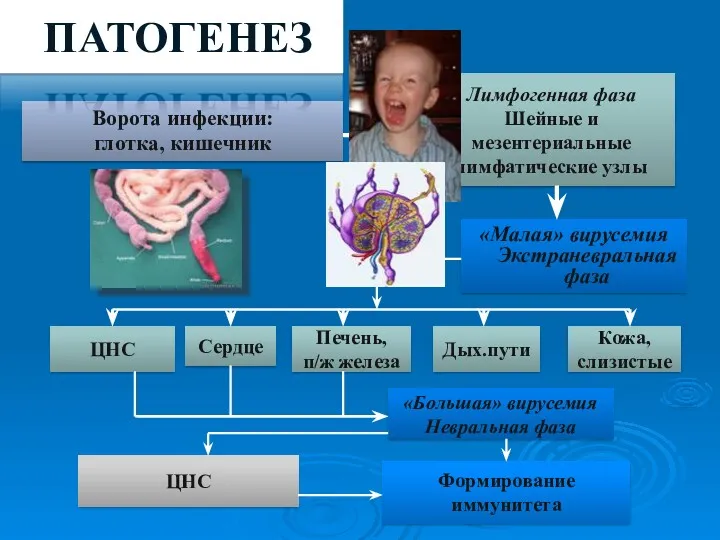 Ворота инфекции: глотка, кишечник Лимфогенная фаза Шейные и мезентериальные лимфатические