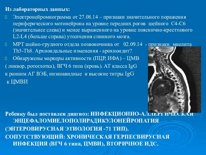 Из лабораторных данных: Электронейромиограмма от 27.08.14 – признаки значительного поражения