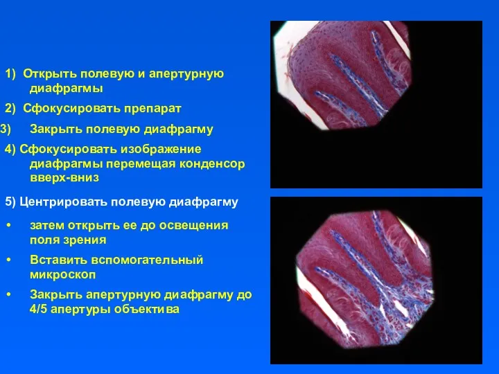 1) Открыть полевую и апертурную диафрагмы 2) Сфокусировать препарат Закрыть