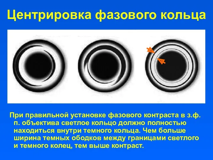 Центрировка фазового кольца При правильной установке фазового контраста в з.ф.п.