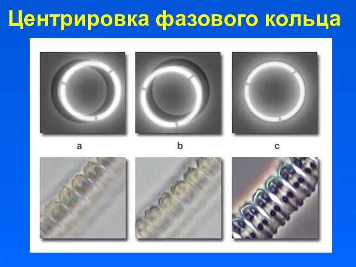 Центрировка фазового кольца