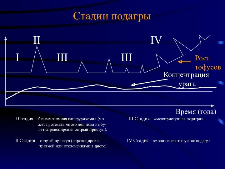 Стадии подагры I Стадия – бессимптомная гиперурикемия (мо- III Стадия