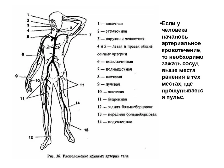 Если у человека началось артериальное кровотечение, то необходимо зажать сосуд