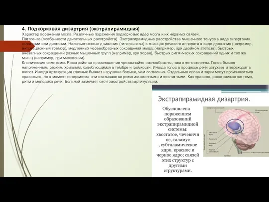 4. Подкорковая дизартрия (экстрапирамидная) Характер поражения мозга. Различные поражения подкорковых