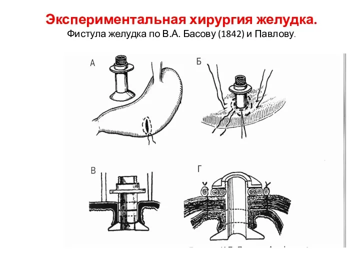 Экспериментальная хирургия желудка. Фистула желудка по В.А. Басову (1842) и Павлову.