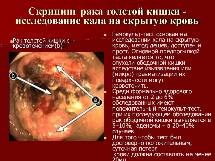 Скрининг рака толстой кишки - исследование кала на скрытую кровь