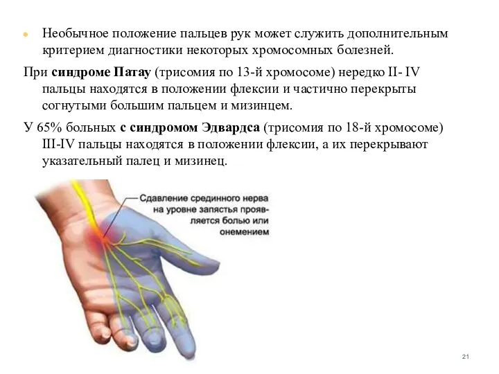 Необычное положение пальцев рук может служить дополнительным критерием диагностики некоторых